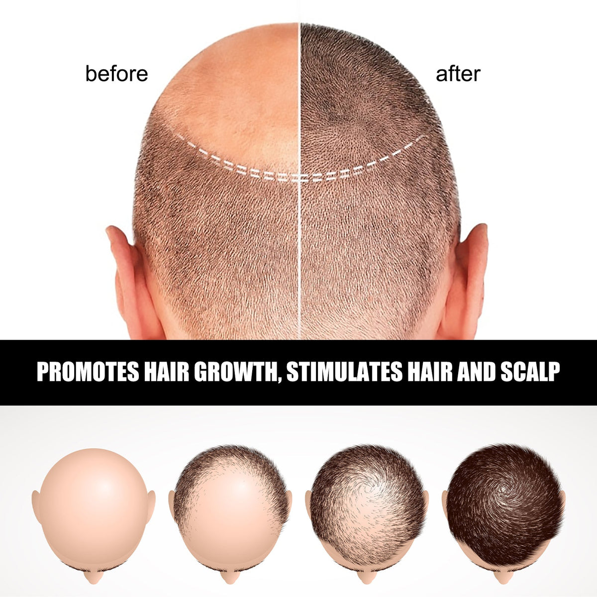 Hair Ampoule Serum – Strengthen, Nourish & Volumise