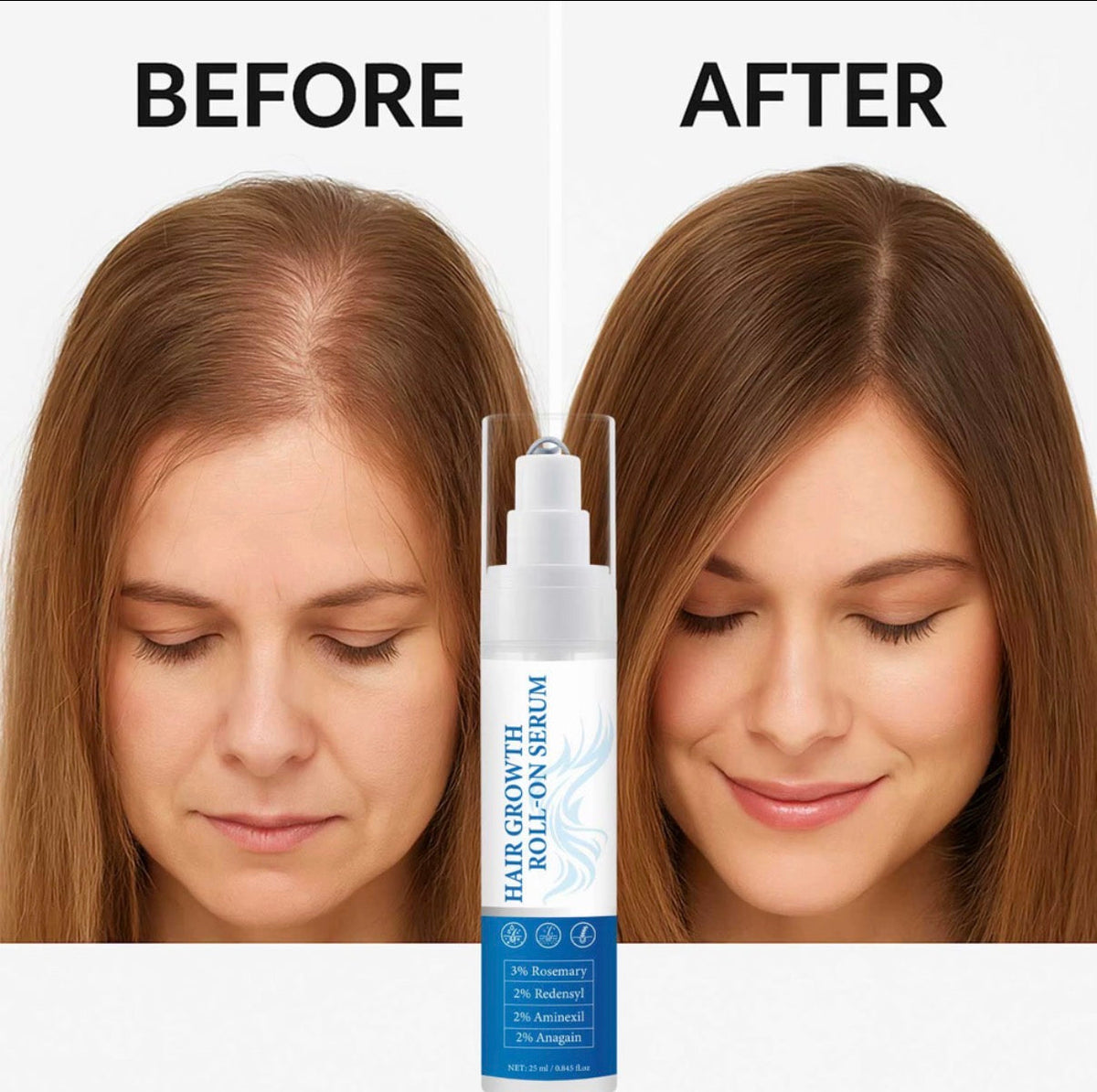 Hair regrowth roll-on serum for hair loss prevention revitalising scalp treatment