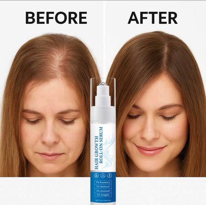 Hair regrowth roll-on serum for hair loss prevention revitalising scalp treatment